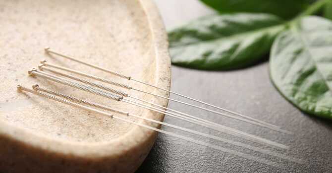 Acupuncture and Anxiety image